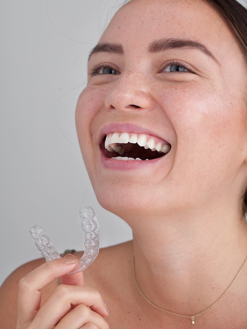 Candid Clear Aligners For Thousands Less Than Braces